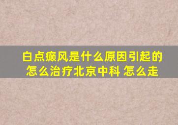 白点癫风是什么原因引起的怎么治疗北京中科 怎么走